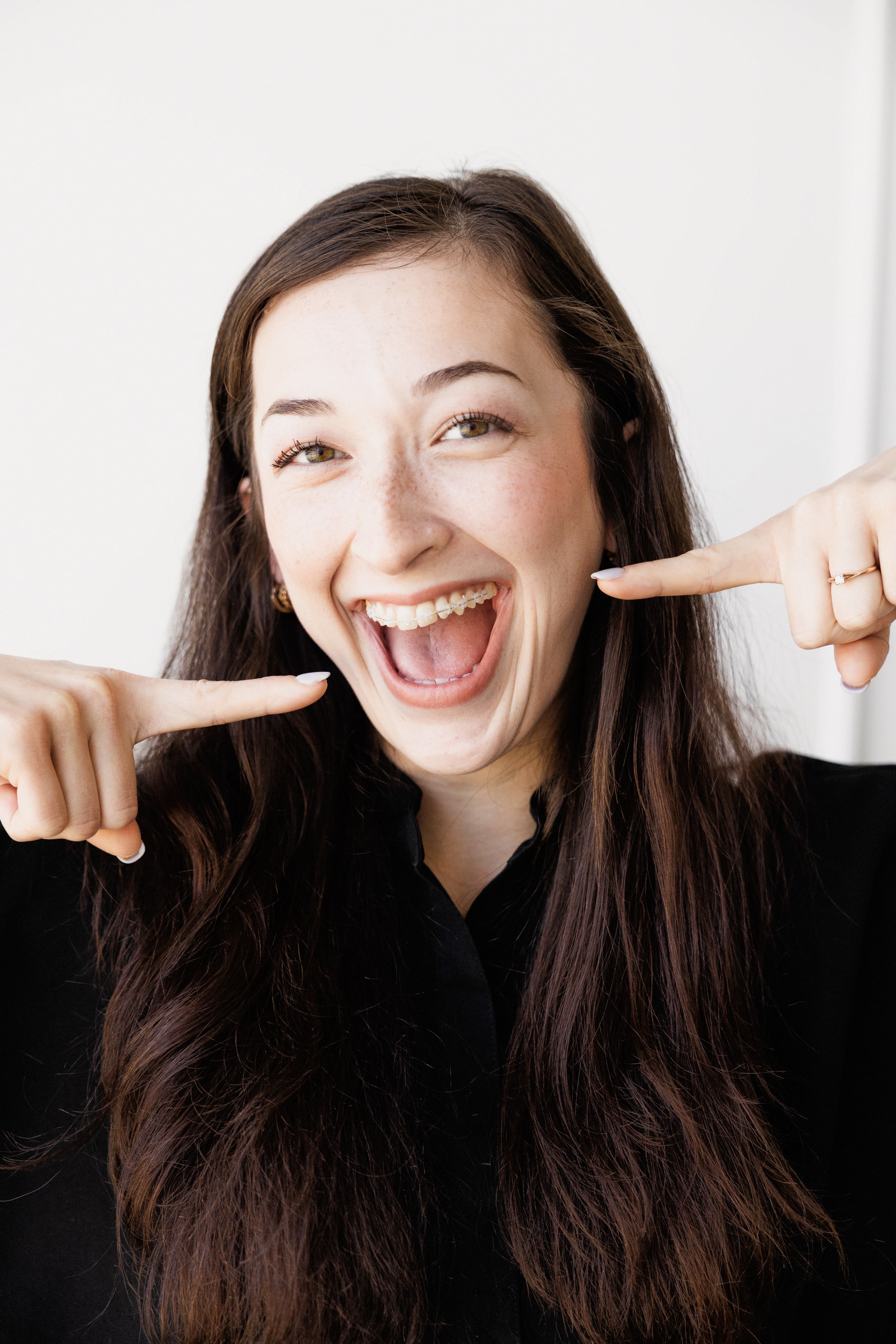 Braces treatment result