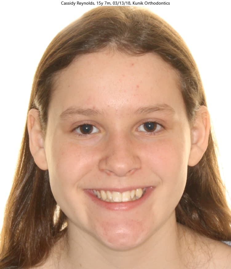 Cassidy before treatment