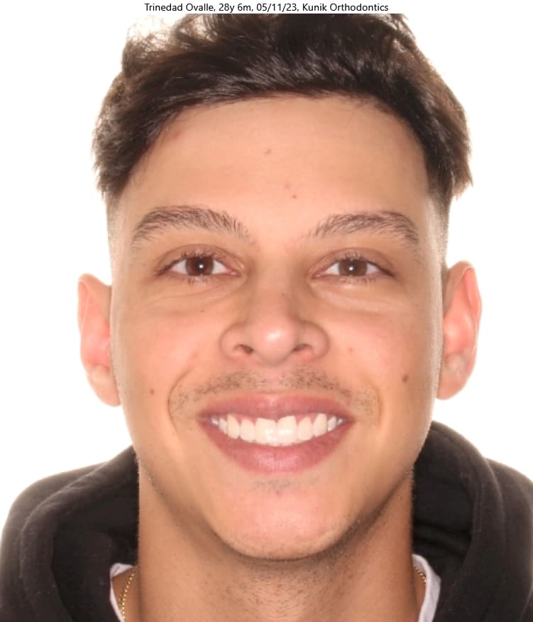 Trinidad after treatment