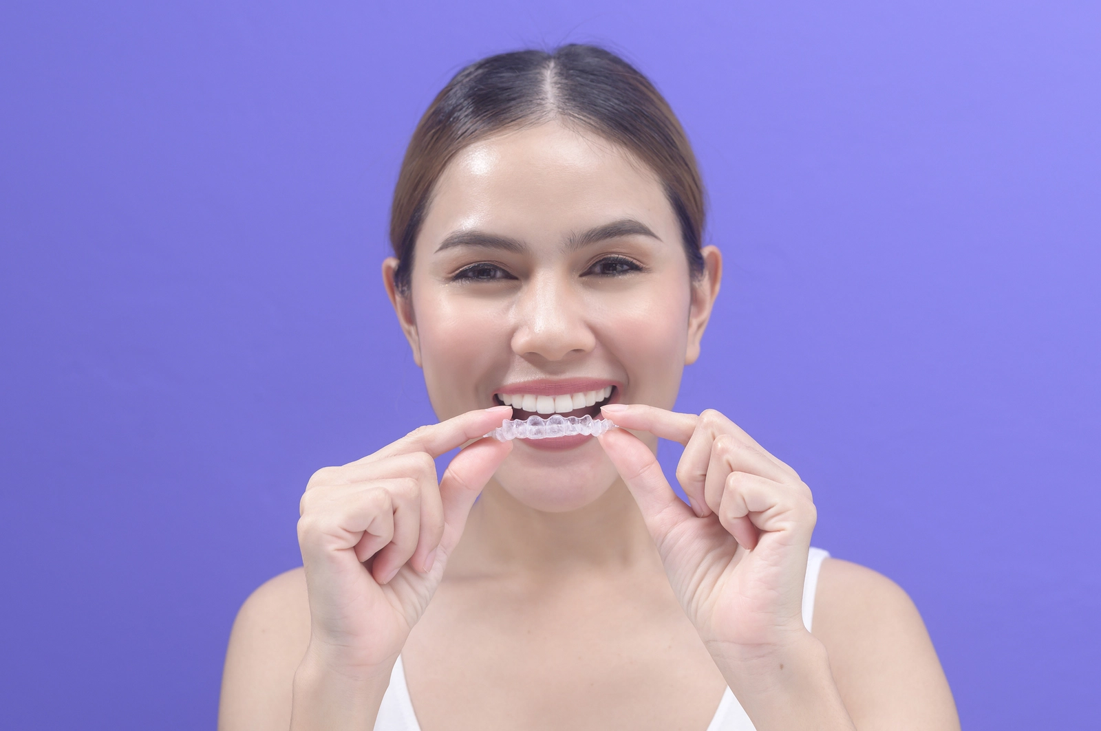 Effectiveness of Invisalign for Crossbite