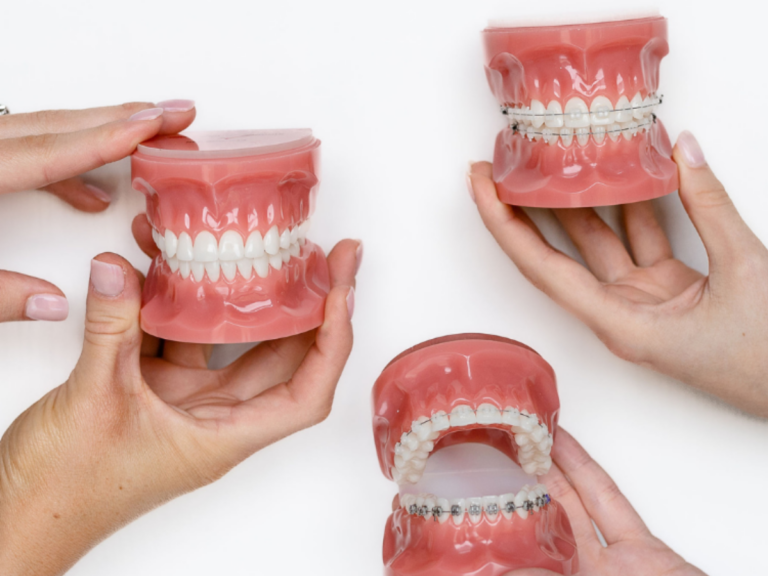 Can Invisalign Fix an Overbite?